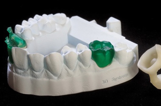 德國率先引入3D打印牙齒技術(shù) 全程體驗(yàn)“無痛”種牙-e鍵打印|3D打印服務(wù)
3d打印牙齒,3D打印種牙,無痛種牙,3D打印平臺,3D打印服務(wù),南京哪里有3D打印,南京3D打印廠家,南京3D打印服務(wù)
