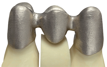 德國率先引入3D打印牙齒技術(shù) 全程體驗(yàn)“無痛”種牙-e鍵打印|3D打印服務(wù)
3d打印牙齒,3D打印種牙,無痛種牙,3D打印平臺,3D打印服務(wù),南京哪里有3D打印,南京3D打印廠家,南京3D打印服務(wù)