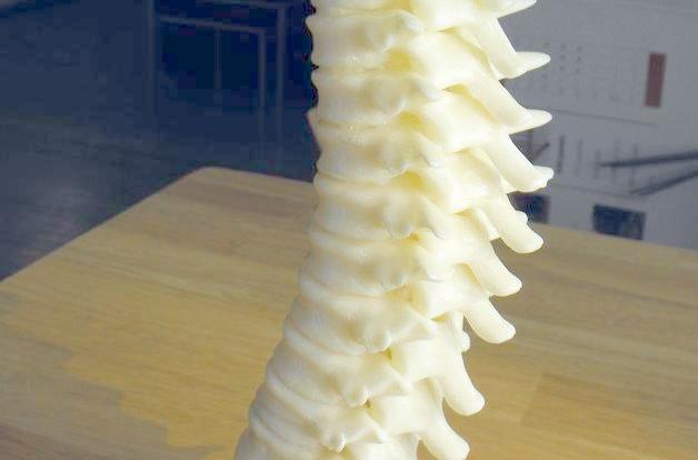 3D打印人體椎骨 3D打印人體椎骨