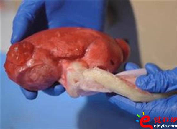 [3d打印醫(yī)療]醫(yī)生手術磨刀石 仿生3D打印心臟及人體器官