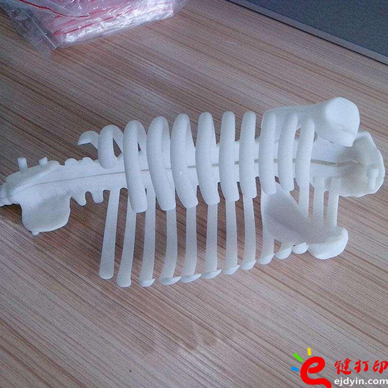 醫療3D打印骨骼模型、3d打印定制手板,3d打印加工手板,3d打印手板模型,3d打印模型,深圳3d打印手板,3d打印手板工廠,工業級3d打印手板公司