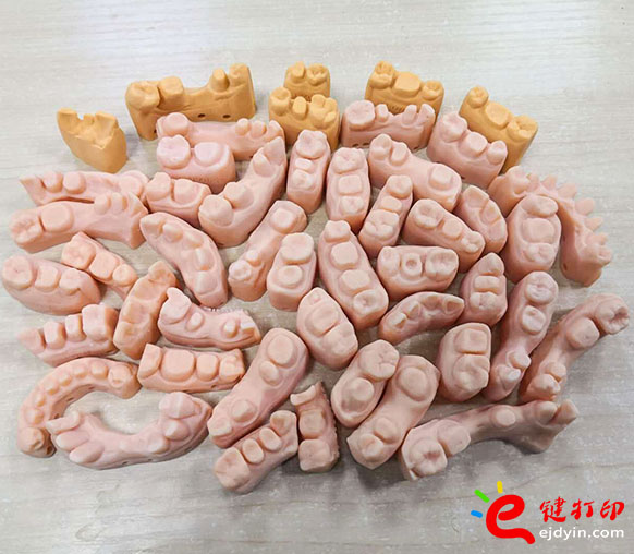 3D打印牙模1