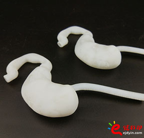 3D打印胃部4